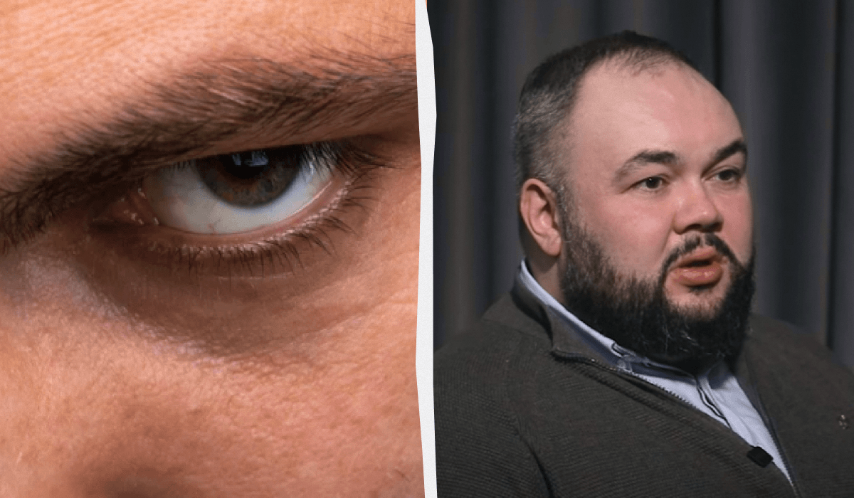 Украинцы стали “злой нацией”? Чтобы выжить – нужна агрессия, – доцент кафедры Богомольца